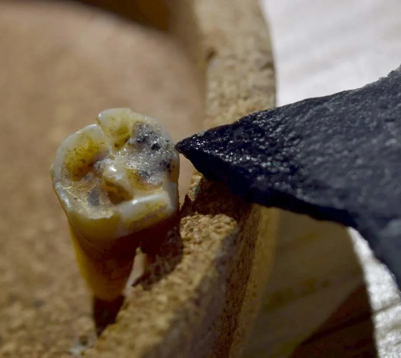 Neandertalci Su Pre 59.000 Godina Bušili Zub Da Ublaže Bol — Najstariji Dokaz Dentalne Intervencije