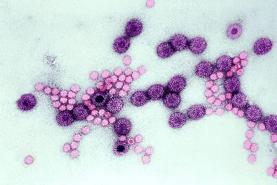 Rotavirus U SAD: Nacionalni Pad Posle Aprila, Ali Zapad Beleži Novi Skok — Šta Roditelji Treba Da Znaju