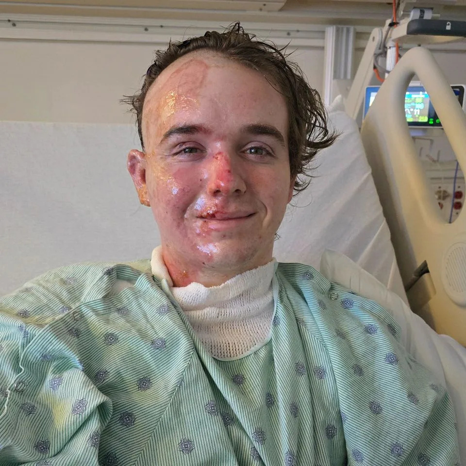 McDonald's Shift Manager Hospitalized With Second‑Degree Burns After Alleged Hot‑Oil Assault
