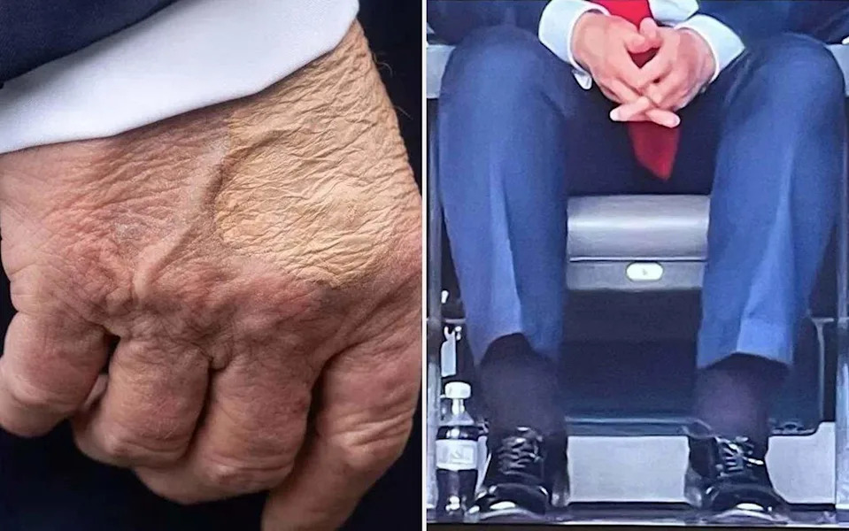Trump Turns 80: 'Sleepy Don' Nickname Fuels Scrutiny of Age, Stamina and Schedule