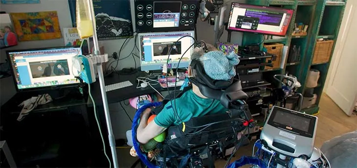Eksperimentalni implantat u mozgu vratio glas muškarcu s ALS-om — digitalni glas podseća na njegov nekadašnji