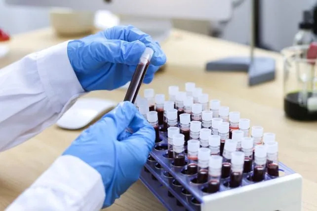 Mlađe Generacije Se Biološki 'Stare' Brže — Mogući Veza Sa Porastom Rana Karcinoma