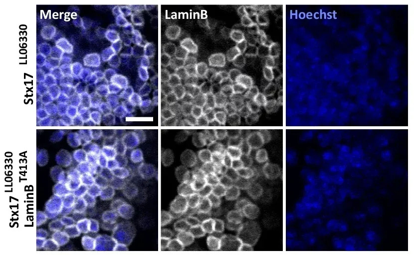 Otkriven Novi Mehanizam Smrti Neurona u Alchajmerovoj Bolesti: Karyoptosis i uloga p38 MAP Kinaze
