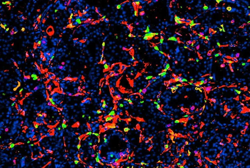 Silicijumske Nanopartikule Sa Cornella Uništile Agresivne Tumore Prostate Kod Miševa — Imunoterapija Se 'Probudi'
