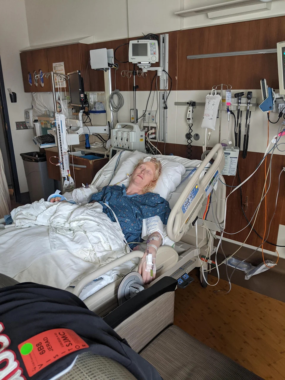 Trudna majka dijagnostikovana sa stadijumom IV melanomom u mozgu — izlečenje nakon dve operacije i imunoterapije