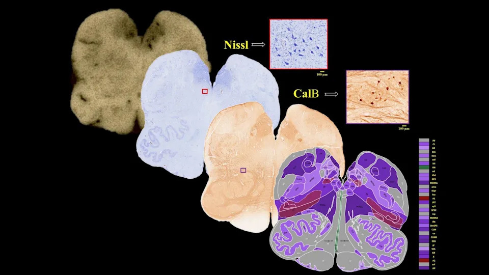 Anchor: Indijski 3D‑atlas moždanog stabla koji povezuje MRI sa pojedinačnim neuronima