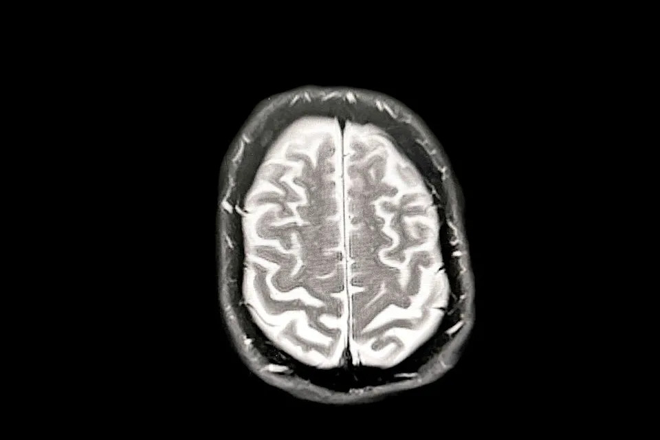 Anchor: Indijski 3D‑atlas moždanog stabla koji povezuje MRI sa pojedinačnim neuronima