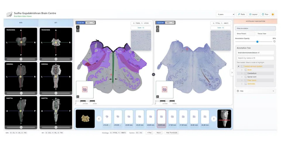 Anchor: Indijski 3D‑atlas moždanog stabla koji povezuje MRI sa pojedinačnim neuronima