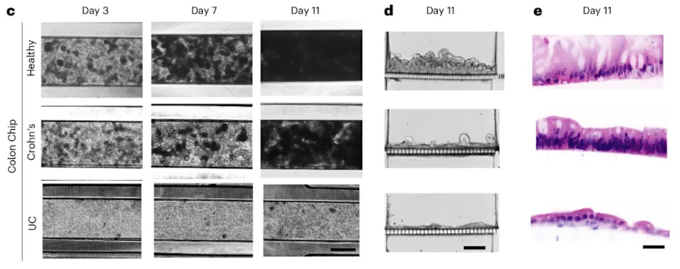 Inflamatorna bolest creva reproducirana na čipu: Colon Chip otkriva ključnu ulogu fibroblasta