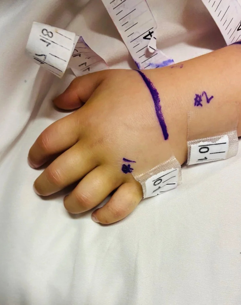 Father Issues Warning After 3-Year-Old Bitten By Rattlesnake Hidden Inside Amazon Package