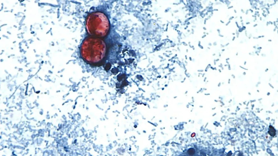 FDA: Lažno‑pozitivan uzorak, ali opoziv Taylor Farms salate ostaje — Kako bezbedno jesti salatu?