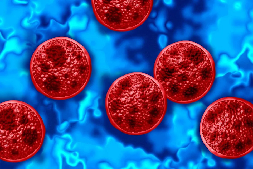 Indiana Man With Cancer Hospitalized After Cyclospora Infection; Family Found Him Gravely Ill