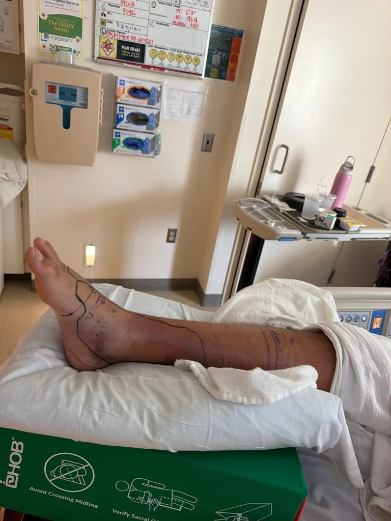 College Baseball Prospect Airlifted After Rattlesnake Bite, Exhausts Local Antivenom Supply