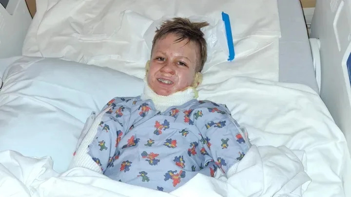 Tabletop Fire Pit Allegedly Explodes During Family Trip, Severely Burns 8-Year-Old