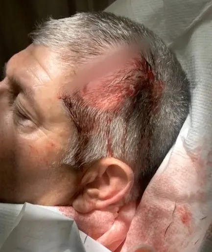 California Family Says They Were Targeted As 'Haole Boys' and Beaten at Luxury Maui Resort