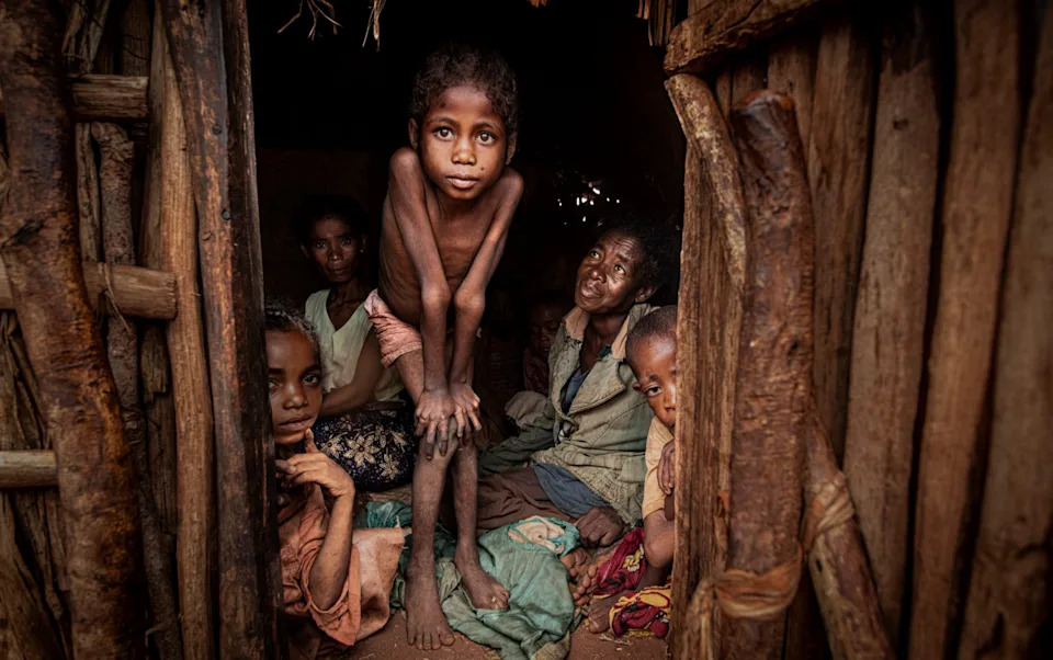 Mpox Outbreak in Madagascar Tops 3,000 Cases as High Test Positivity Suggests Wider Spread