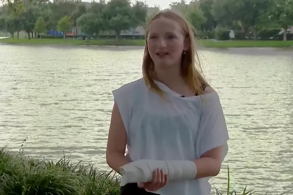 Texas Teen To Undergo Surgery After Rare Barracuda Bite During Turks And Caicos Vacation