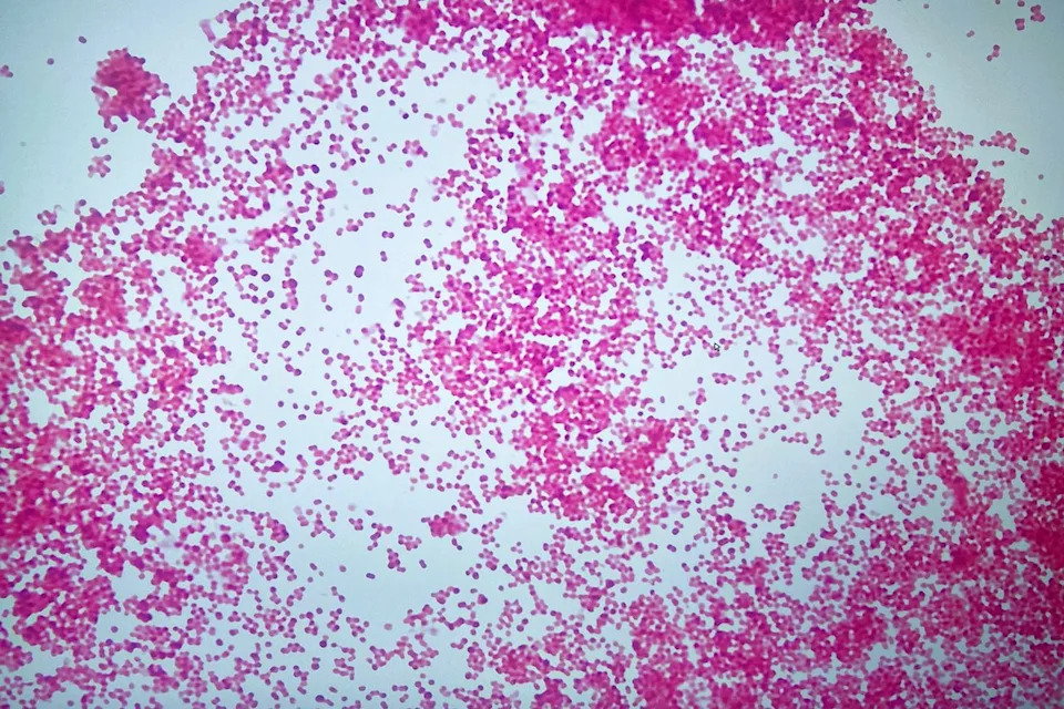 Laboratorijska greška u Juti: 33 osobe primile antibiotike nakon pogrešne identifikacije meningokoka