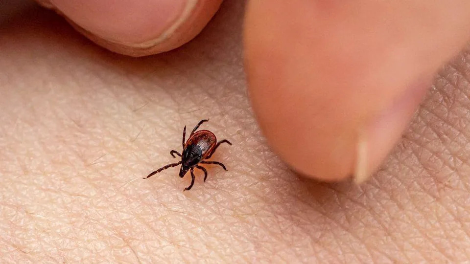 Žena iz Velsa u komi 42 dana nakon ujeda krpelja: upozorenje o TBE i kako se zaštititi