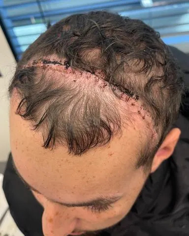 Posle Četiri Borbe Sa Leukemijom, 21-godišnji Conor Harding Dijagnostikovan Sa Neizlečivim Glioblastomom