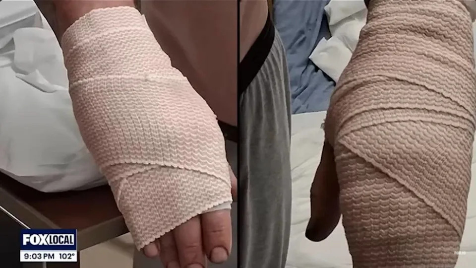 Kako Taseri Mogu Zapaliti Benzinske Isparenja — Šta Pokazuje Incident Na Pumpi U Arizoni