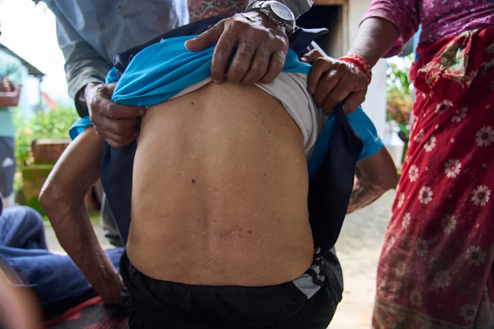 Crop‑Raiding Macaques Devastate Nepal's Rural Farms — Villagers Keep Watch at Dawn