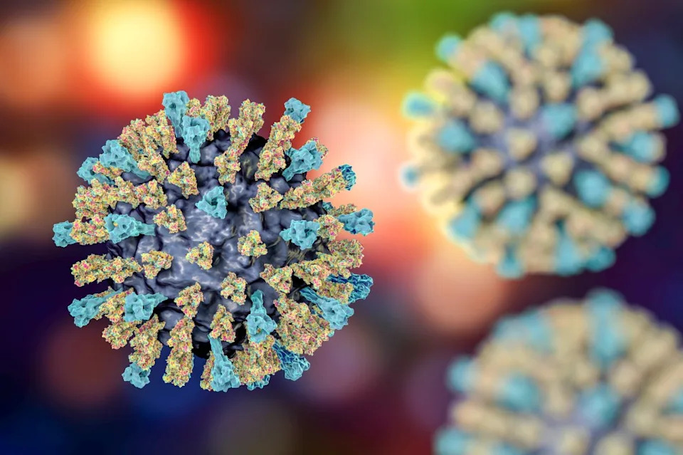 Measles Exposure at Universal Studios Hollywood After Infected Visitor Spent 11 Hours in Park