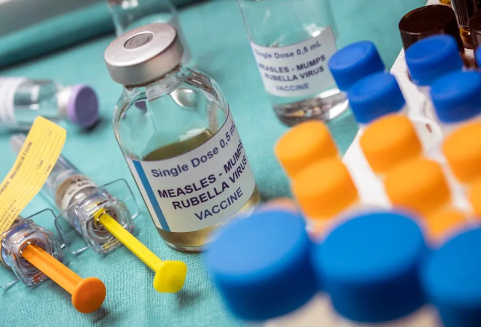 Measles Exposure at Universal Studios Hollywood After Infected Visitor Spent 11 Hours in Park