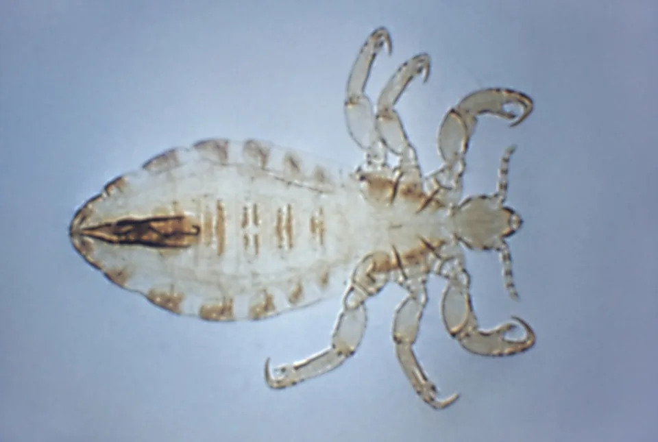 After Typhus Returns To Los Angeles, Could Bubonic Plague Follow?