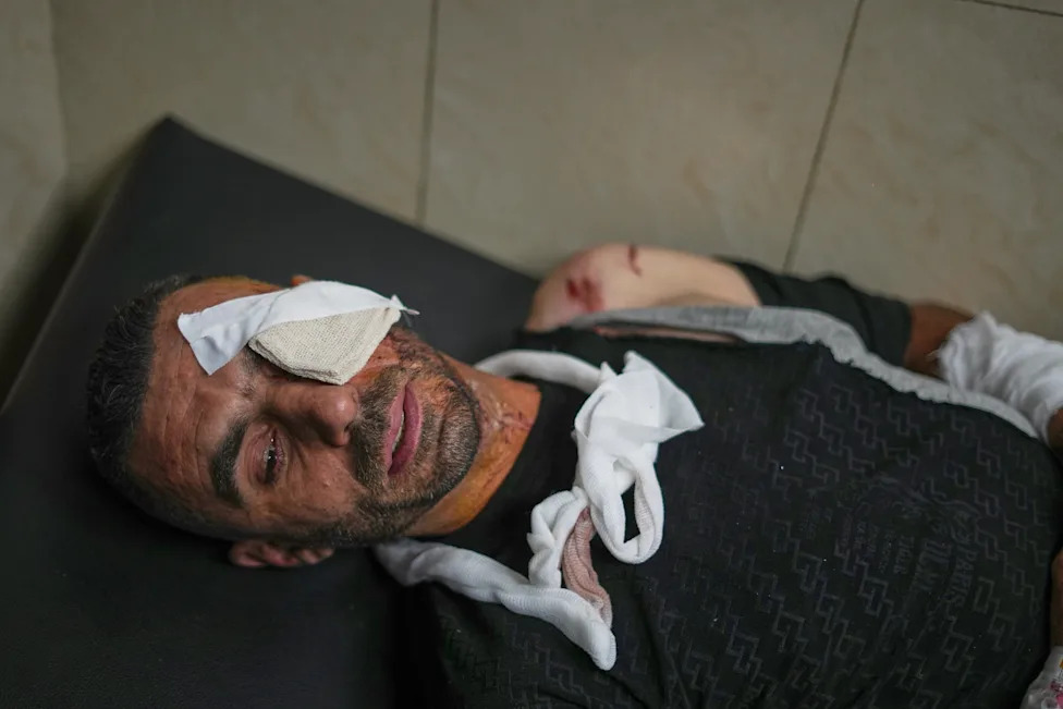 Damascus Suburb Minivan Blast: Health Ministry Revises Toll To 14 Wounded, No Deaths