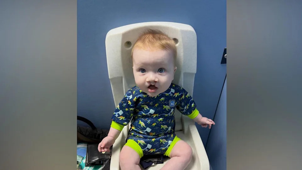 Father Fears Time-Critical Cleft Surgery Delay After Northern Ireland's Only Specialist Resigns