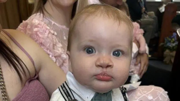 Father Fears Time-Critical Cleft Surgery Delay After Northern Ireland's Only Specialist Resigns