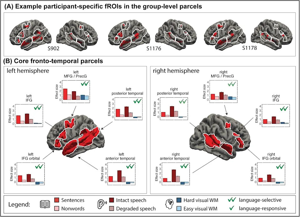 MIT Otkriva Skriveni Jezički Sistem — 17 Dodatnih Regija U Mozgu