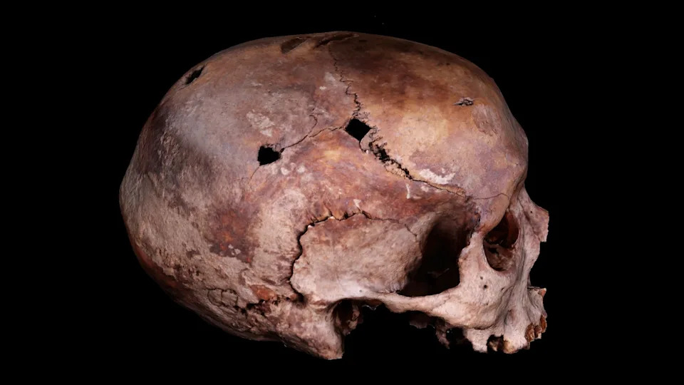 „Berserker“ Buzdovan Otkrio Misteriju Kvadratnih Rupa u Lobanjama Iz Bitke kod Visbya (1361)