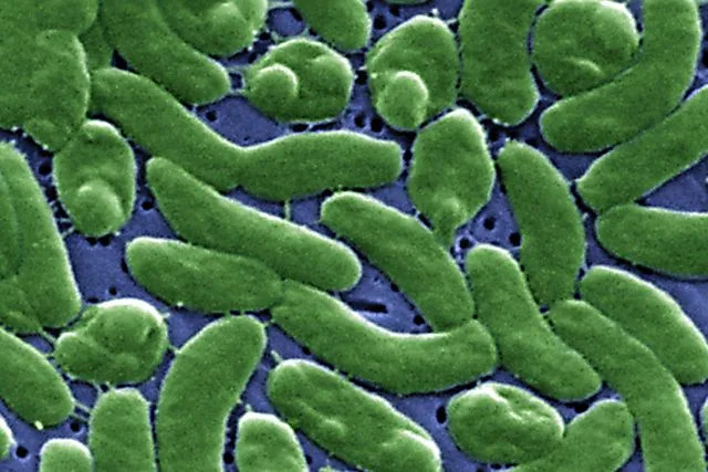 Žena Izgubila Veliki Deo Noge Zbog Vibrio vulnificus: „Ne Brijte Se Pre Ulaska U More“