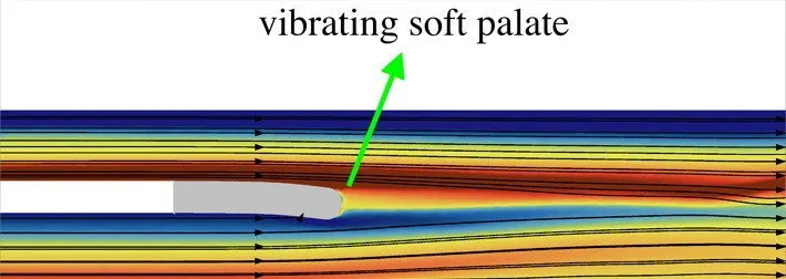 Naučno otkriće iz Švedske: 3D model otkriva kako nestabilan protok vazduha stvara glasno hrkanje