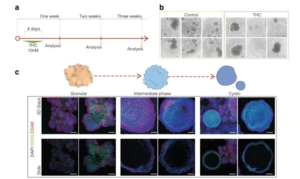 Otkriven Receptor Kanabisa Koji Može Smanjiti Širenje Raka Dojke — Novi Preklinički Rezultati