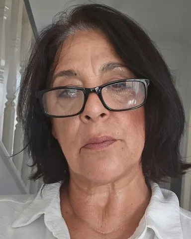Propust Lekara Koštao Je Vida: Žena Izgubila Vid U Levom Oku Zbog Kasne Dijagnoze Giant Cell Arteritisa