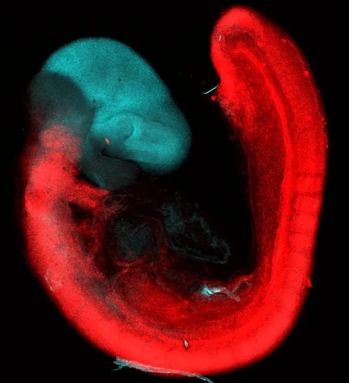 Stanford Finds Human Brain Is Two Ancient Nervous Systems Packaged Together