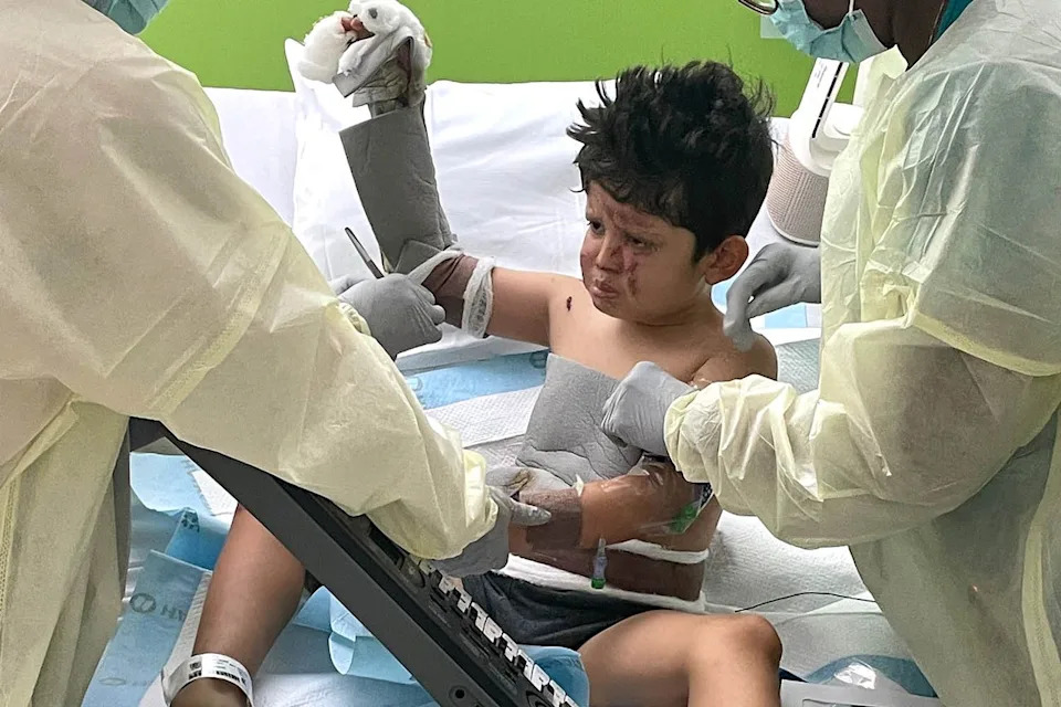 7-Year-Old Severely Burned After Home 'Science Experiment' Ignites Shirt — Family Rallies to Help