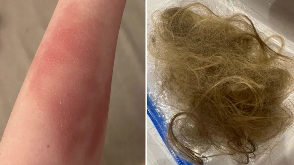 ‘Miracle’ Wrist Device Dramatically Eases 13‑Year‑Old’s Severe Tourette Tics