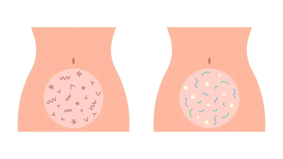 Some Gut Bacteria Can Spread Across Continents Within Decades, New Genomic Study Finds