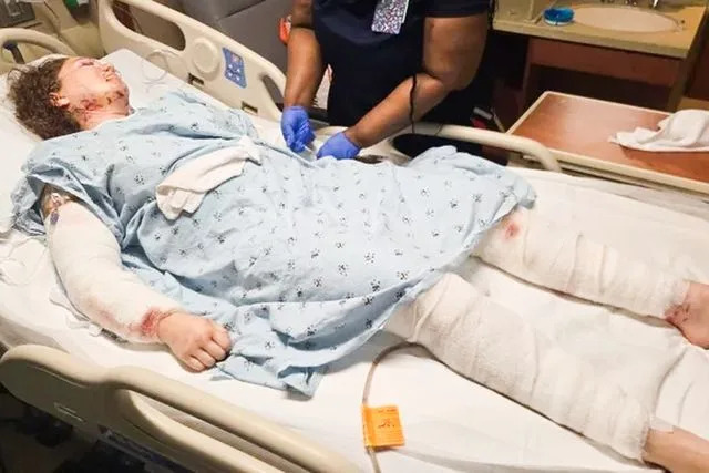 Seven Pit Bulls Allegedly Spill From U‑Haul, Maul Neighbors in Charlotte — Two Owners Charged
