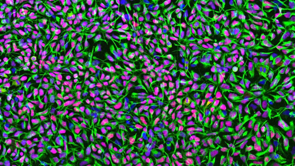 Human Stem Cell Grafts Rebuild Neural Circuits and Improve Movement in Stroke-Damaged Mice