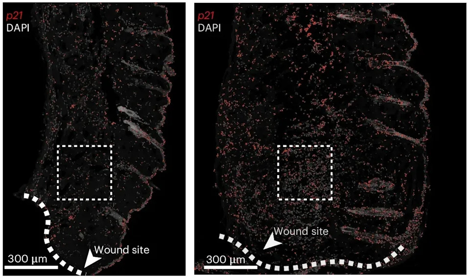 MIT's RamanOmics Uses Light to Detect Senescent Cells Non‑Destructively