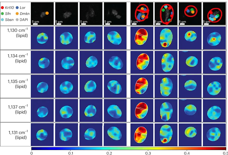 MIT's RamanOmics Uses Light to Detect Senescent Cells Non‑Destructively