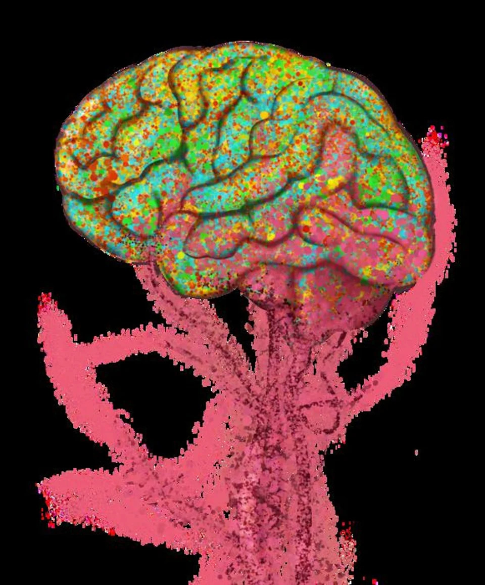 Bone Marrow Damage May Explain Why Alzheimer’s Fails to Heal Itself, New Study Suggests