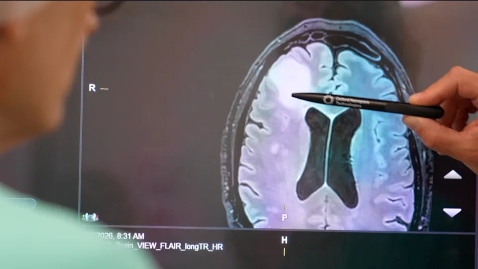 From Weeks To Hours: NHS Pilots Rapid Genomic Test That Transforms Brain Tumour Diagnosis