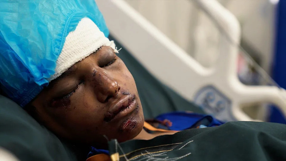 Inside Taiz: Families on Yemen's Front Line as Houthis Push for Control