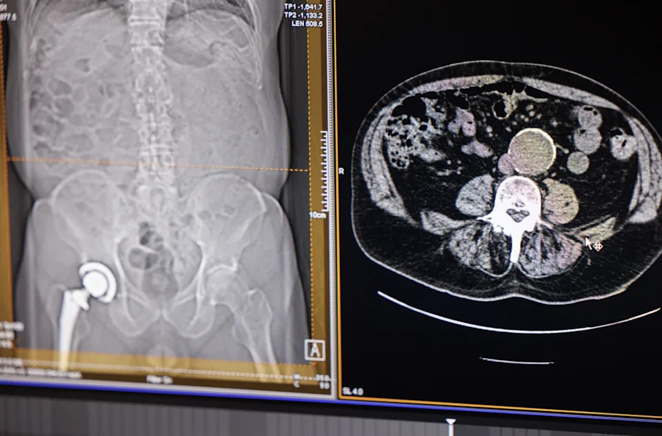 MUSC and Siemens Launch Accelerated CT Technologist Program to Ease Staffing Shortage